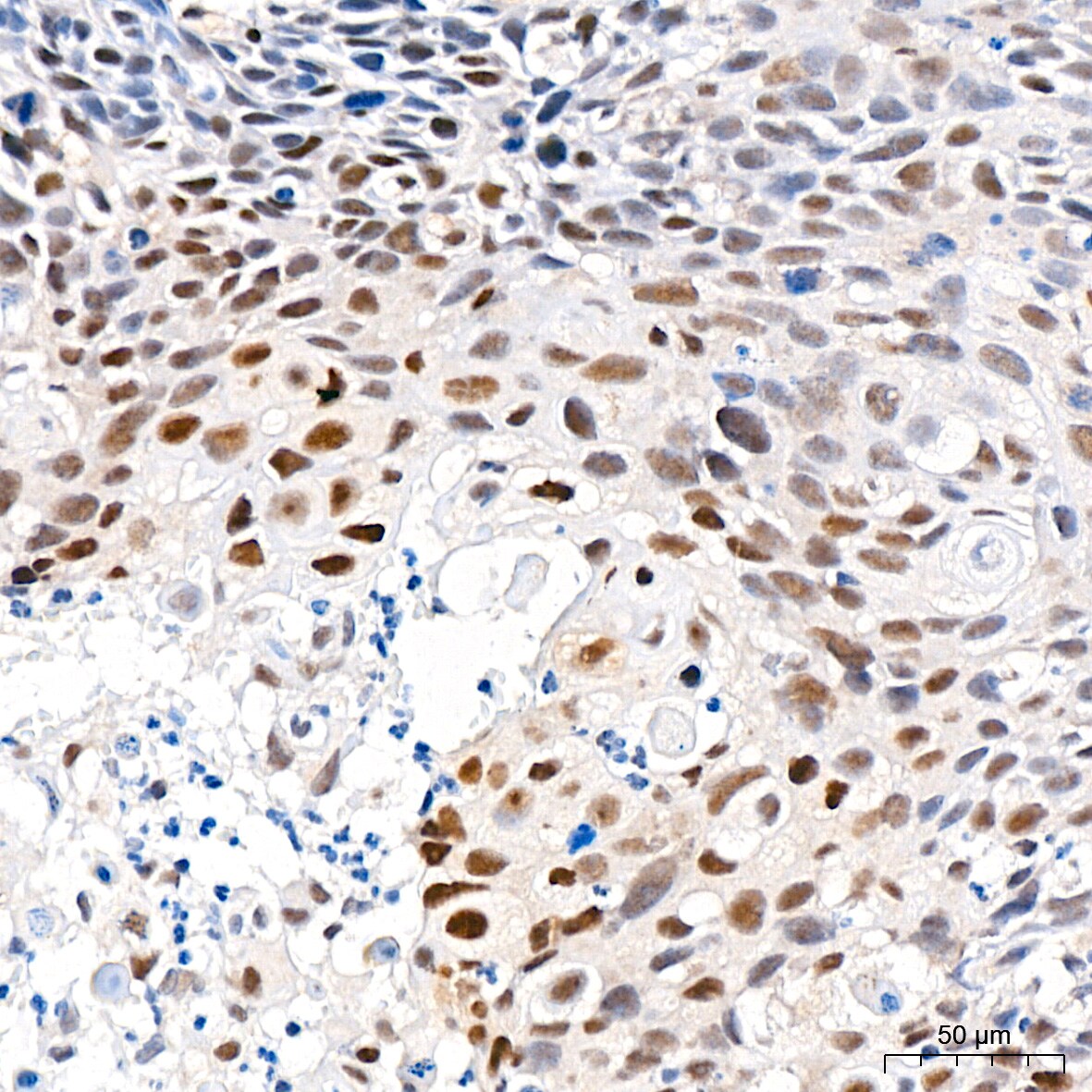 6 Phosphofructo 2 Kinase Antibody (7X10D9)