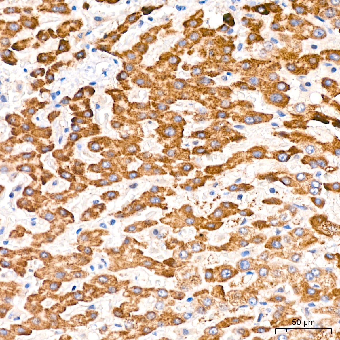 6 Phosphofructo 2 Kinase Antibody (7X10D9)