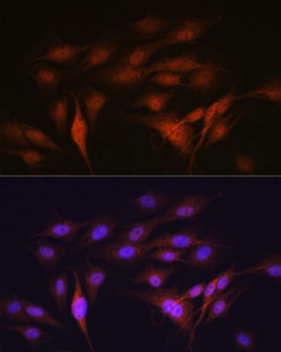 LXR alpha/NR1H3 Antibody (7Z4H10)
