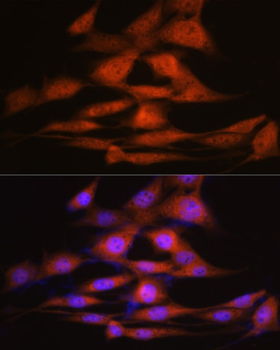 LXR alpha/NR1H3 Antibody (7Z4H10)