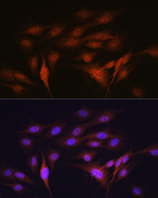 LXR alpha/NR1H3 Antibody (7Z4H10)