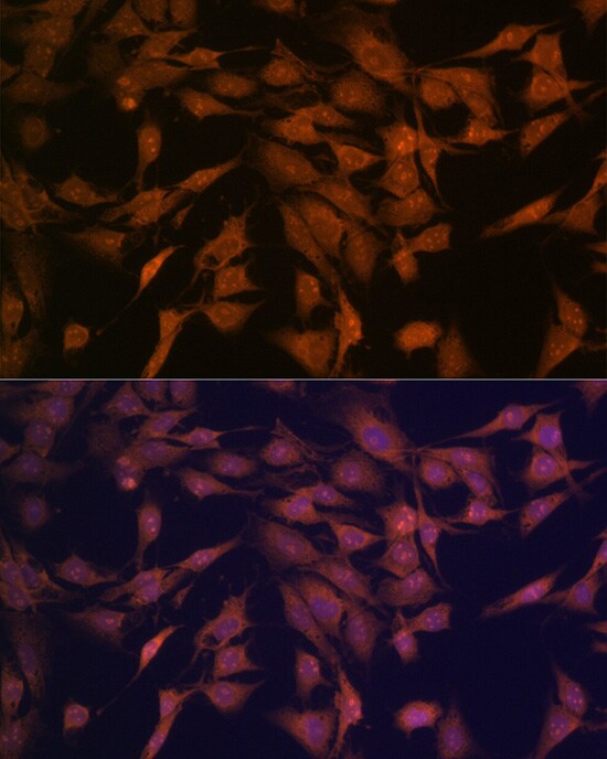 CENPC Antibody (5E3K5)