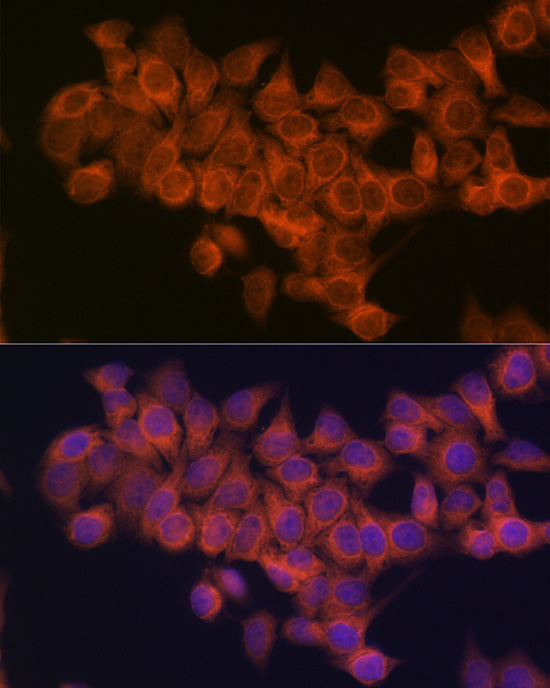 NDUFAF1 Antibody (4K8Y8)