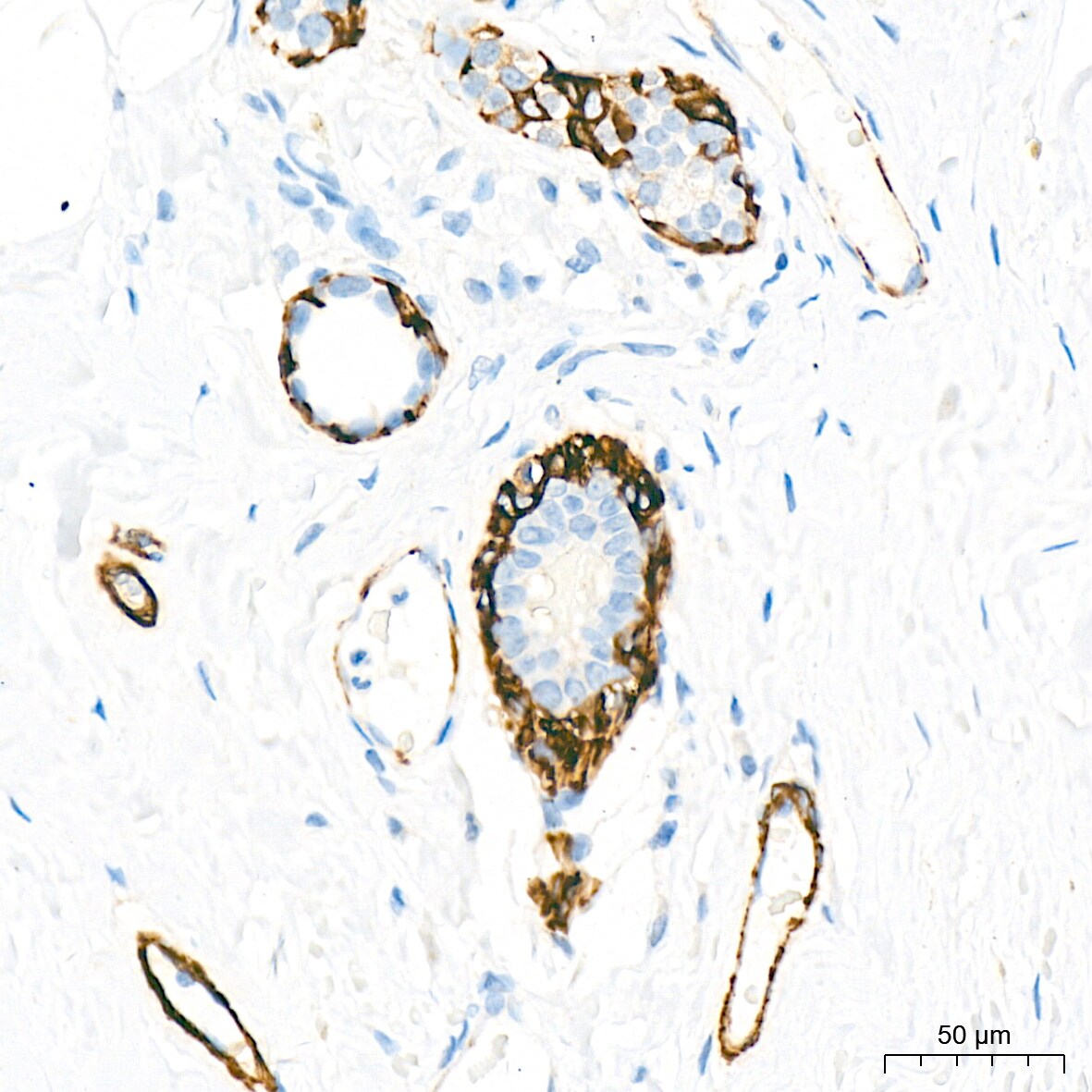 Myosin heavy chain 11 Antibody (0O4O4)