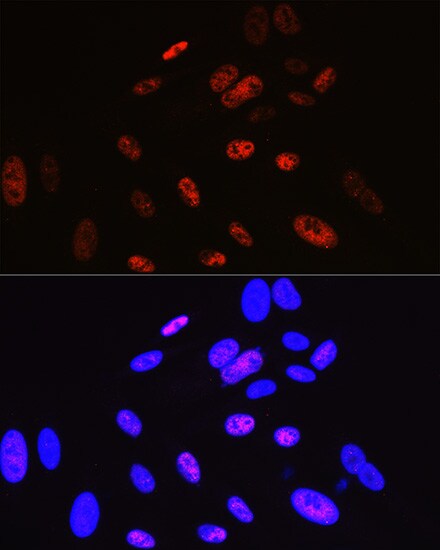 Cyclin H Antibody (3N5S3)