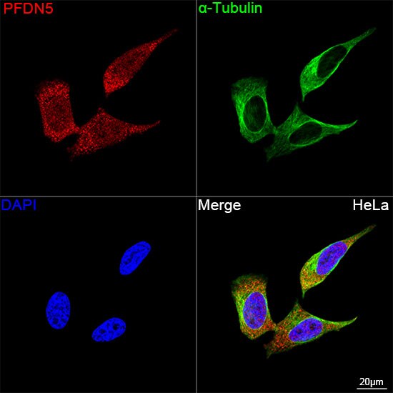 PFDN5 Antibody (9Y5H7)
