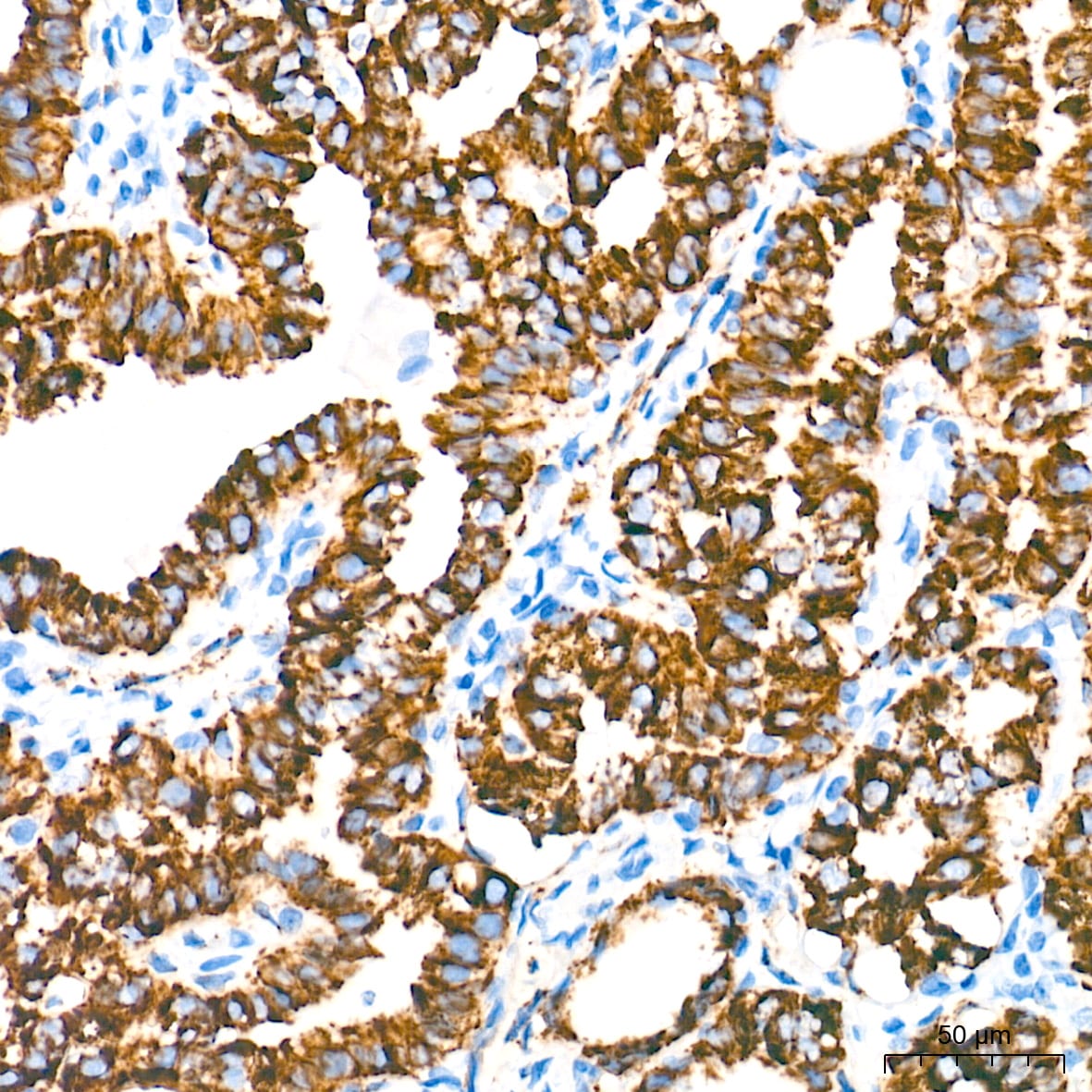 MAO-A Antibody (9U8P8)