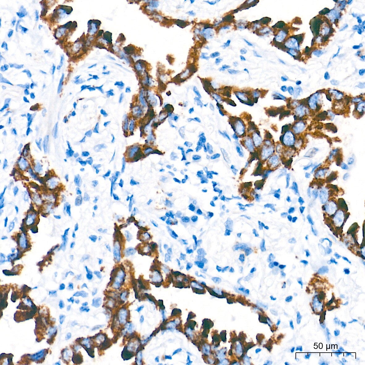 MAO-A Antibody (9U8P8)