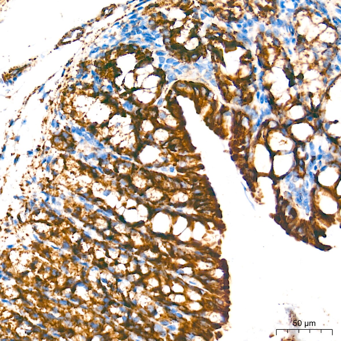 MAO-A Antibody (9U8P8)