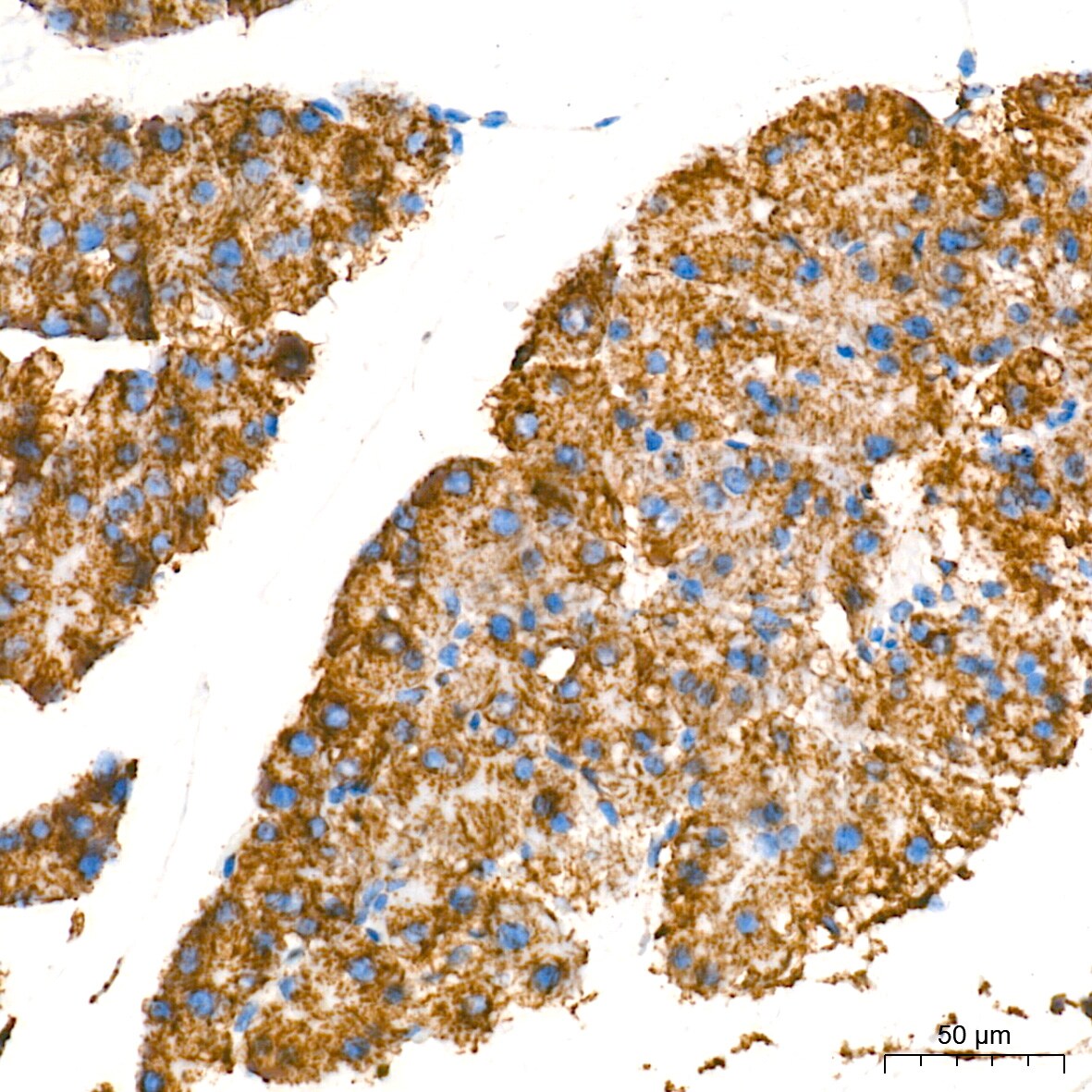 MAO-A Antibody (9U8P8)