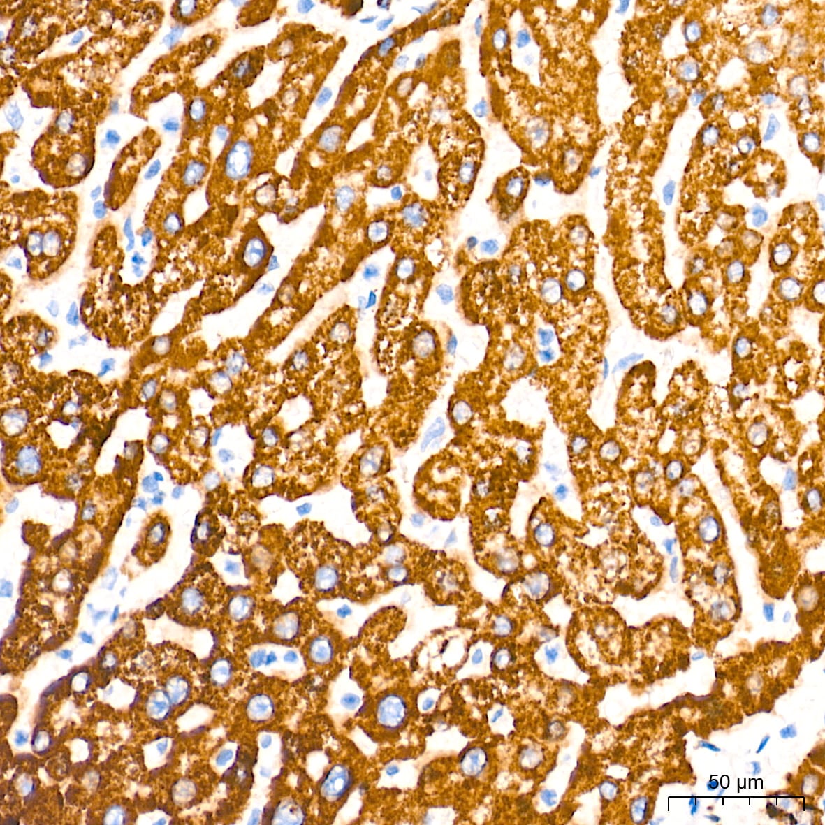 MAO-A Antibody (9U8P8)