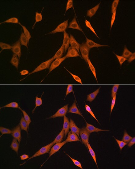 RhoC Antibody (7X5I9)