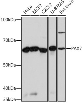 Pax7 Antibody (5G2Q9)