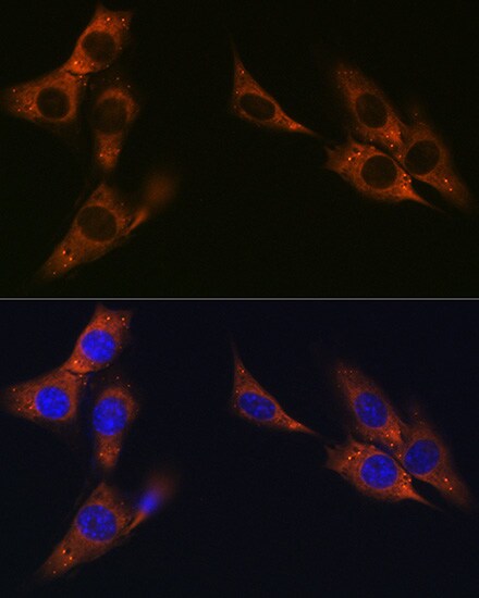 gamma Catenin Antibody (9O2K8)