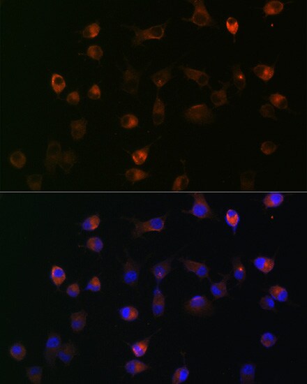 gamma Catenin Antibody (9O2K8)