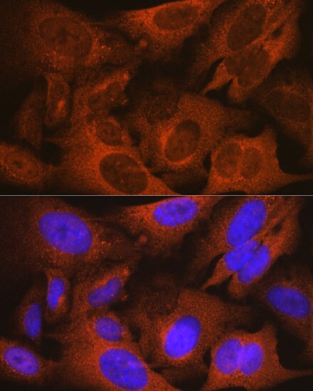 PSP94/MSMB Antibody (4L8B5)