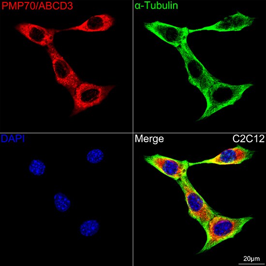 PMP70 Antibody (3V4K3)