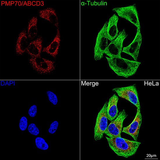 PMP70 Antibody (3V4K3)