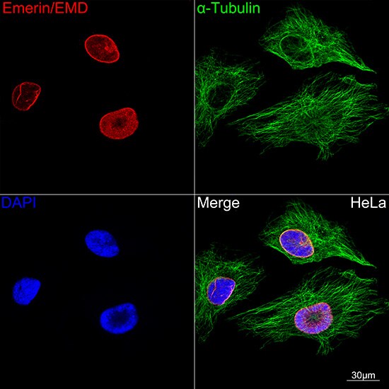 Emerin Antibody (10Y5K9)