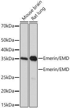 Emerin Antibody (10Y5K9)