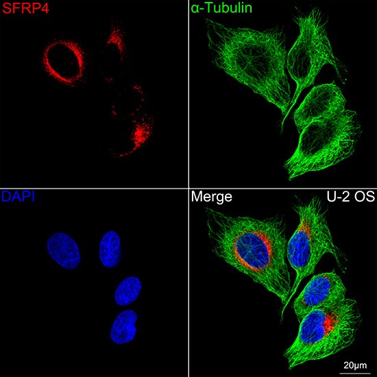 sFRP-4 Antibody (7Z6Q1)