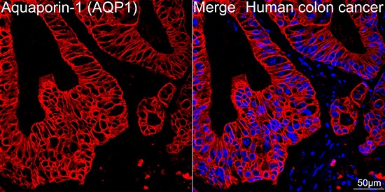 Aquaporin 1/AQP1 Antibody (8V1O3)
