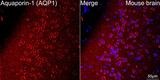 Aquaporin 1/AQP1 Antibody (8V1O3)