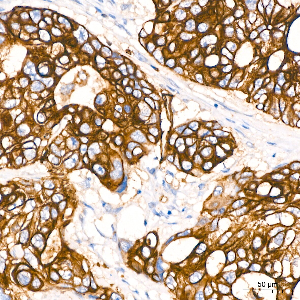 Aquaporin 1/AQP1 Antibody (8V1O3)
