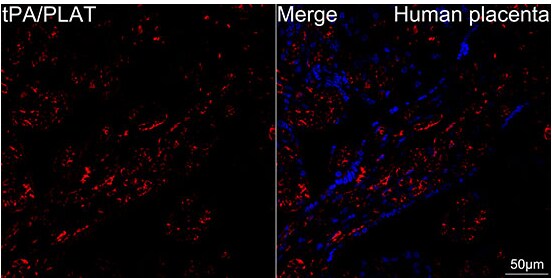 t-Plasminogen Activator/tPA Antibody (10W4L1)