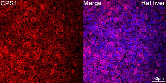 CPS1 Antibody (1R6W3)