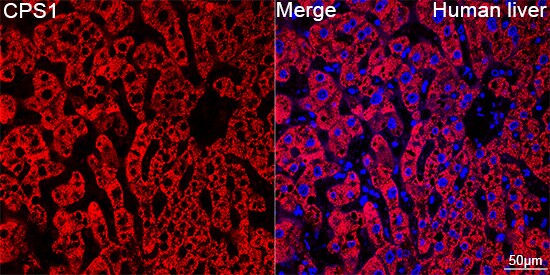 CPS1 Antibody (1R6W3)