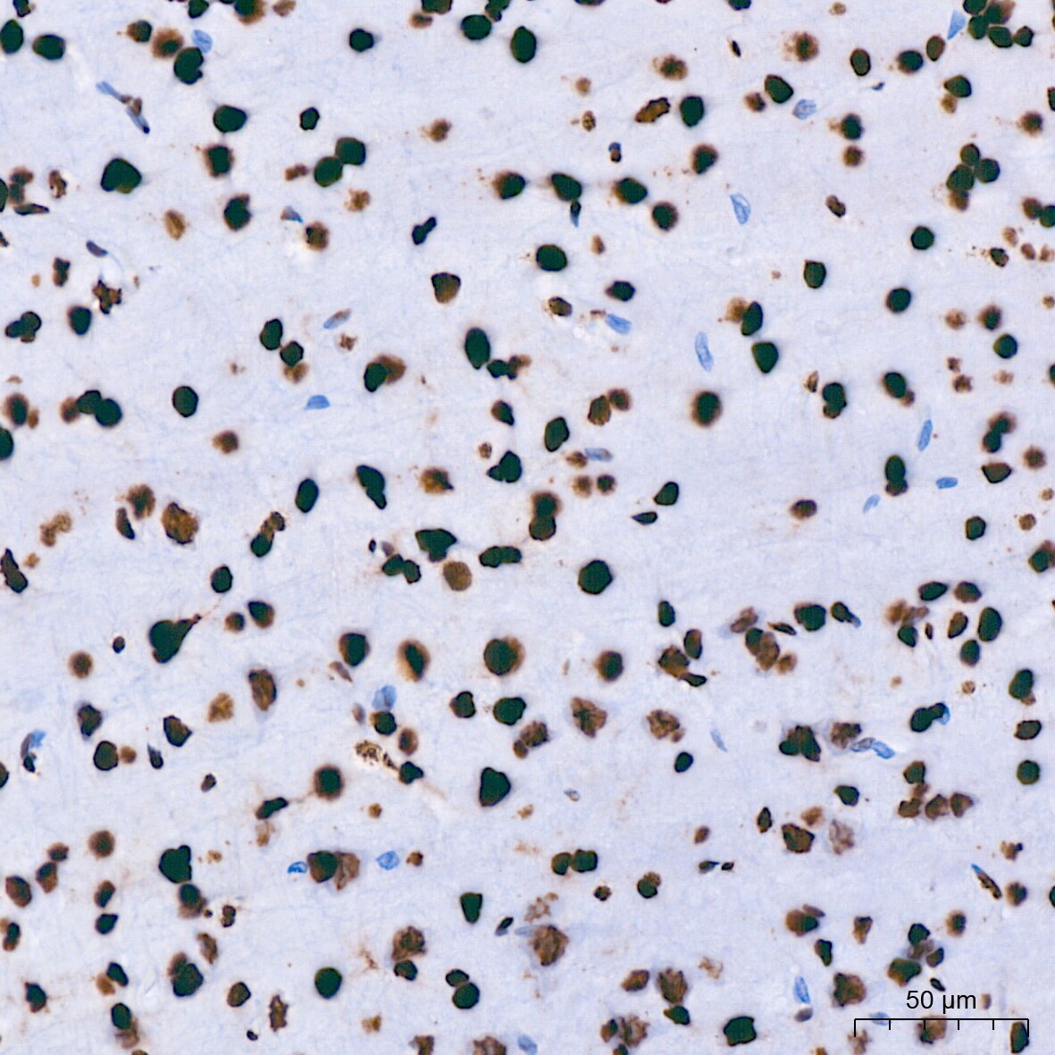 hnRNP U Antibody (3R3F1)