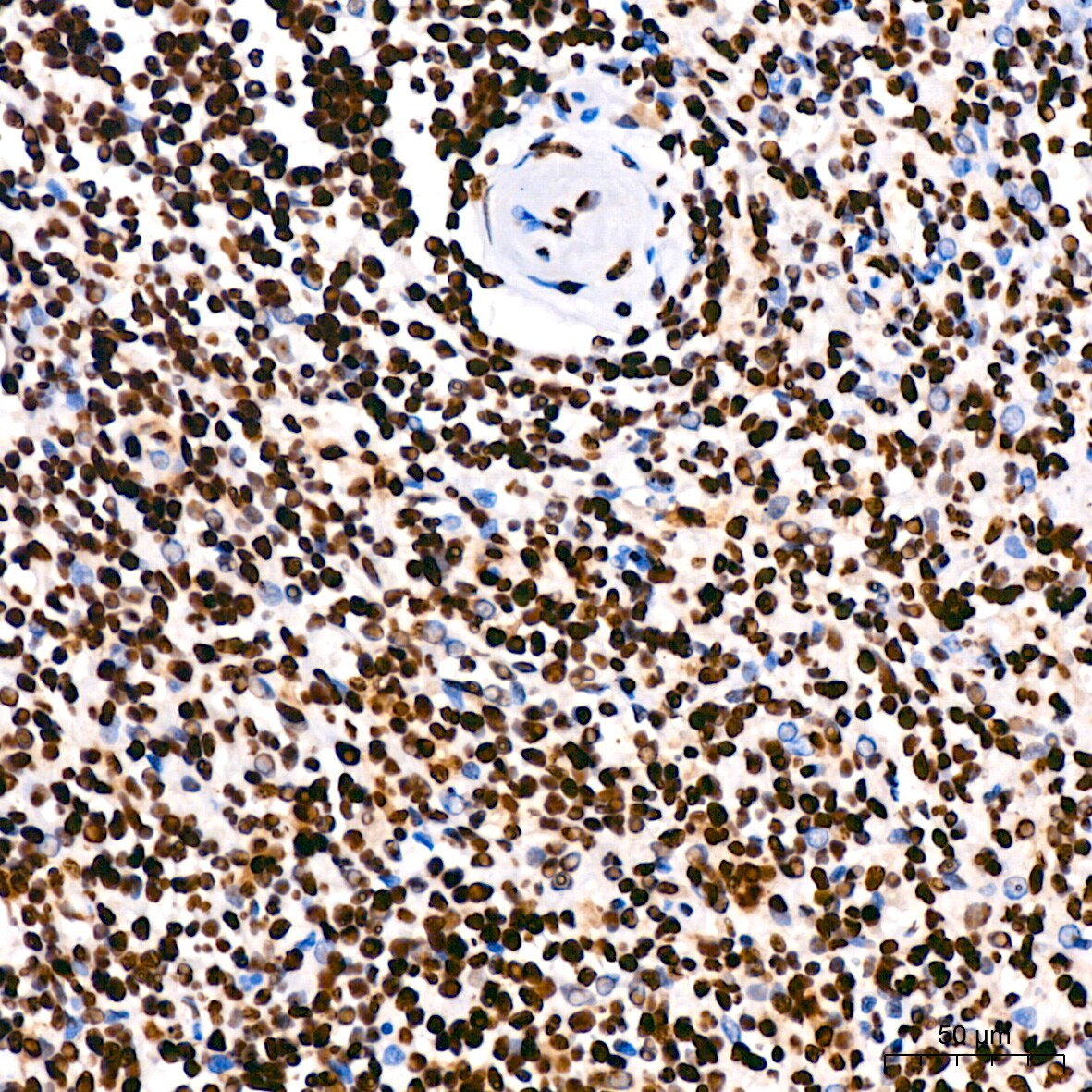 hnRNP U Antibody (3R3F1)
