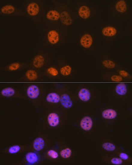 SMARCC1 Antibody (1R7I6)