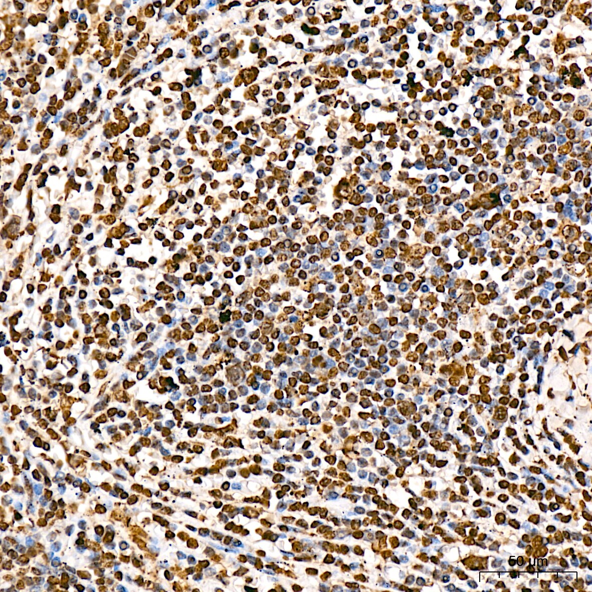 Aly Antibody (6I4T10)