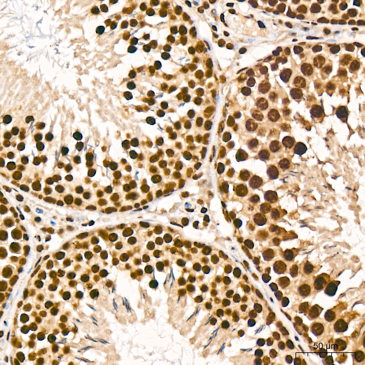 Aly Antibody (6I4T10)