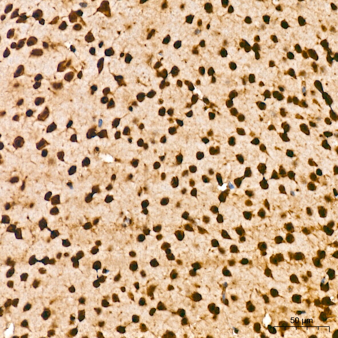Aly Antibody (6I4T10)