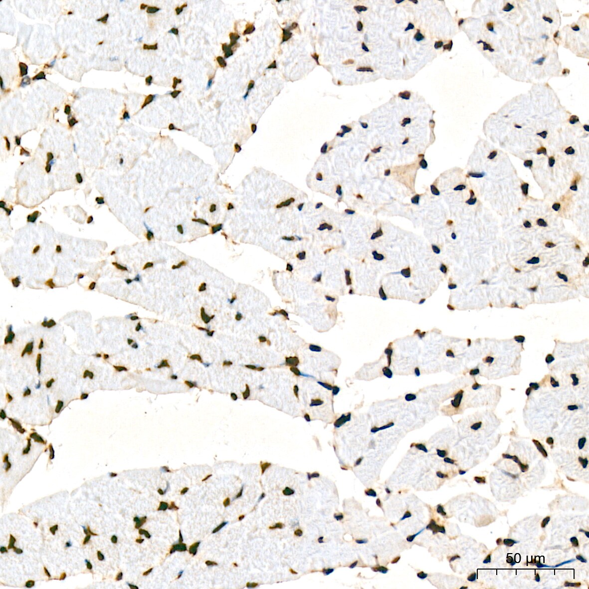 Aly Antibody (6I4T10)