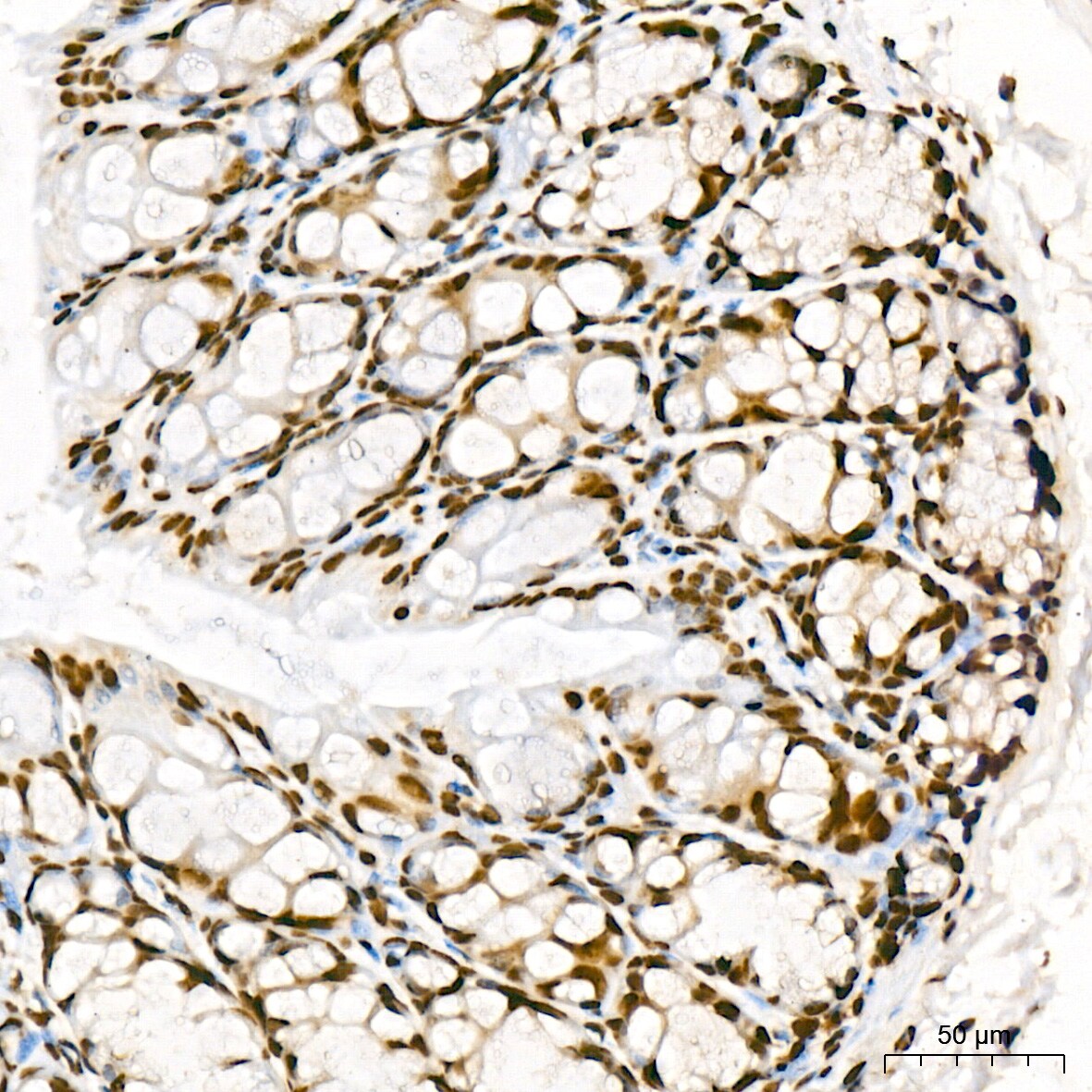 Aly Antibody (6I4T10)