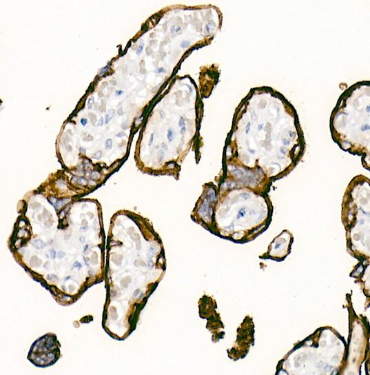 Alkaline Phosphatase/ALPP/ALPI Antibody (10Q2X7) Alkaline Phosphatase/ALPP/ALPI Antibody (10Q2X7)