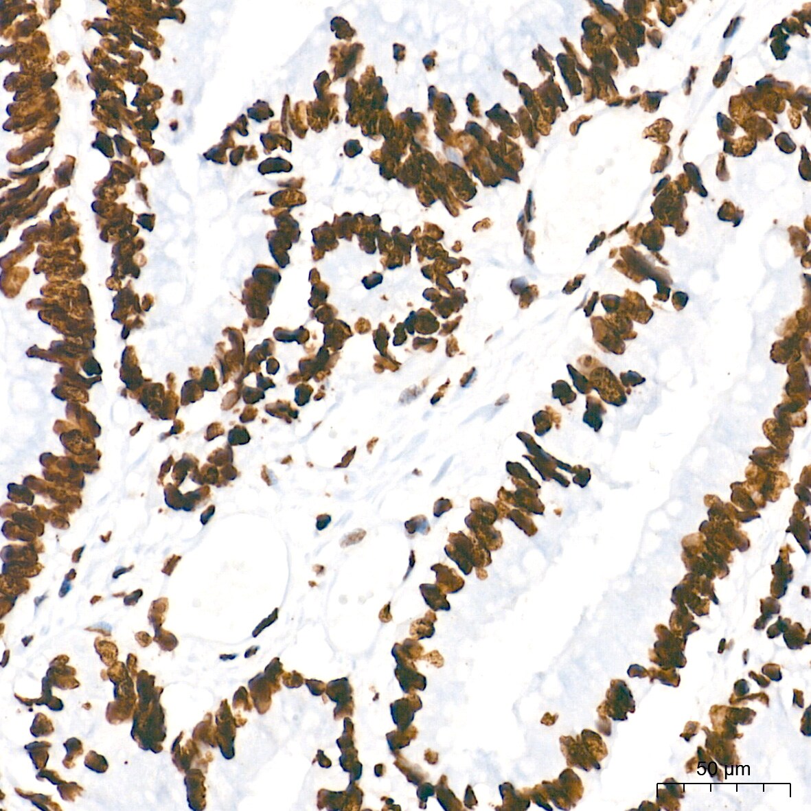 HMGA1 Antibody (5J0E6)