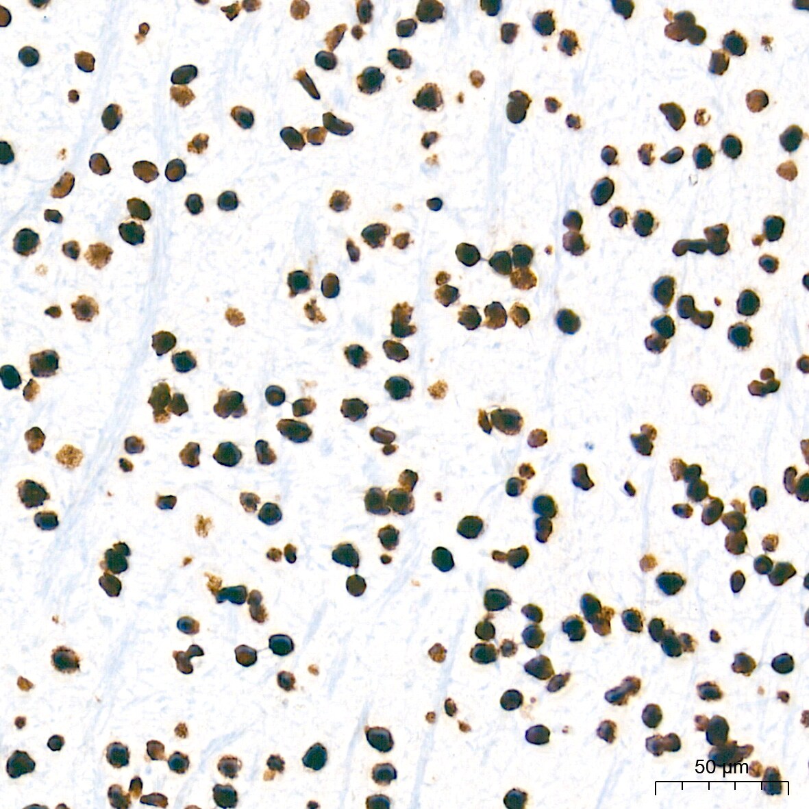 HMGA1 Antibody (5J0E6)