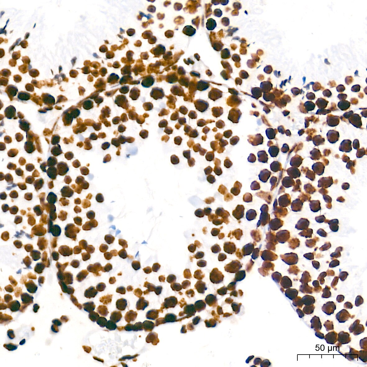 HMGA1 Antibody (5J0E6)
