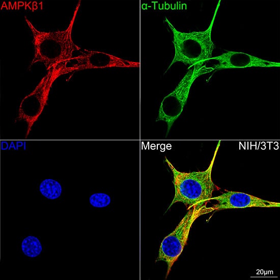 AMPK beta 1 Antibody (7G8U1)