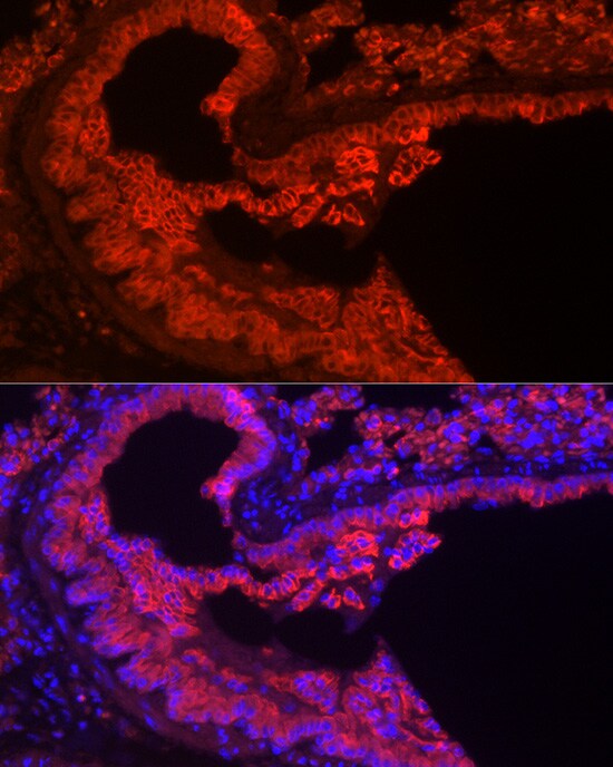 Cytokeratin 7 Antibody (5V4M10)