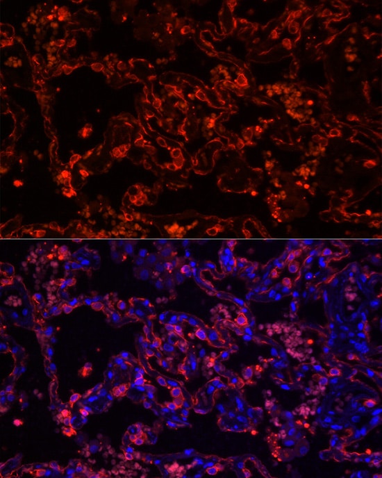 Cytokeratin 7 Antibody (5V4M10)