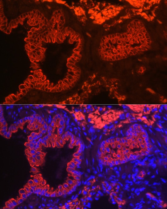 Cytokeratin 7 Antibody (5V4M10)