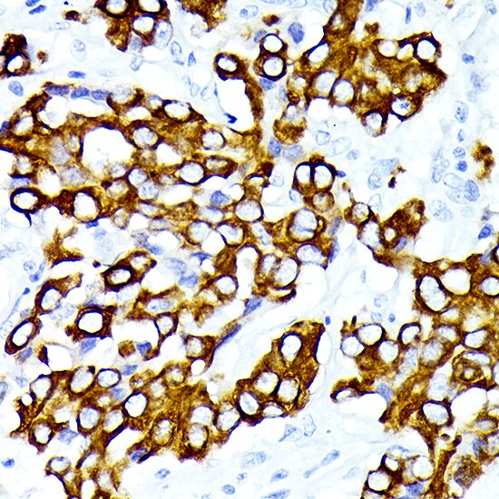 Cytokeratin 7 Antibody (5V4M10)