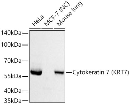 Cytokeratin 7 Antibody (5V4M10)