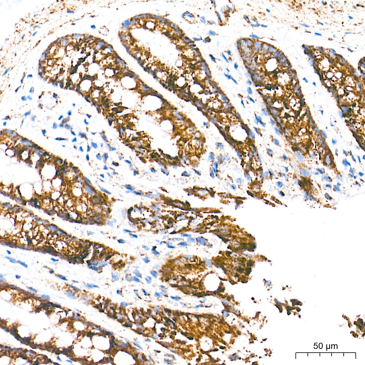 UQCRC2 Antibody (3E3O8)